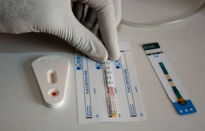 Một số điều cần biết về xét nghiệm HIV